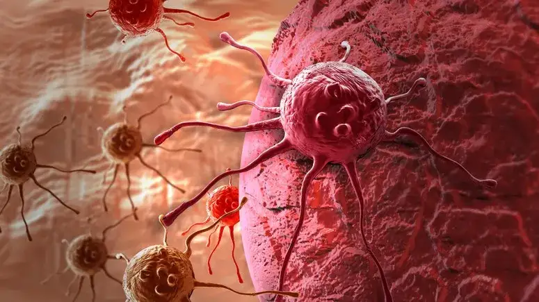 Czy wynaleziono lek na raka? Oto najnowsze informacje o terapiach