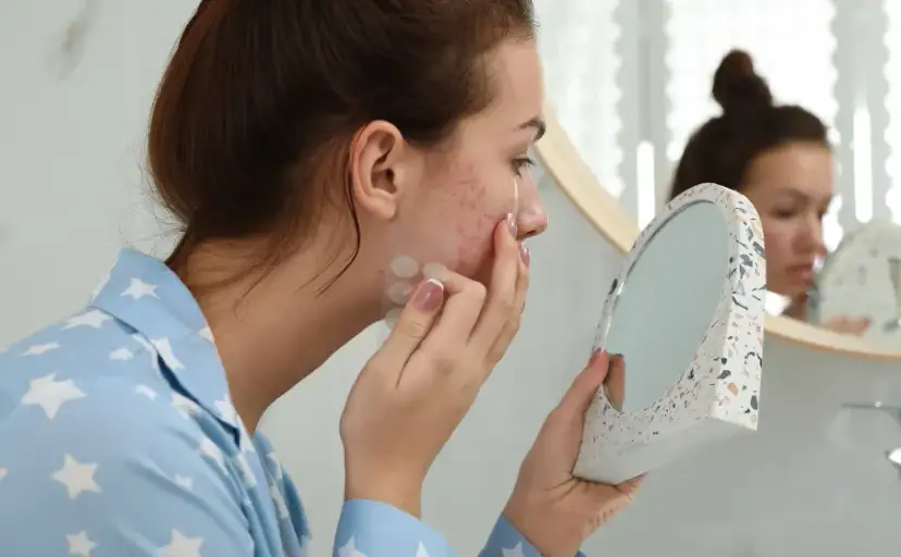 Skuteczne plastry na niedoskonałości - jak szybko je zlikwidować?