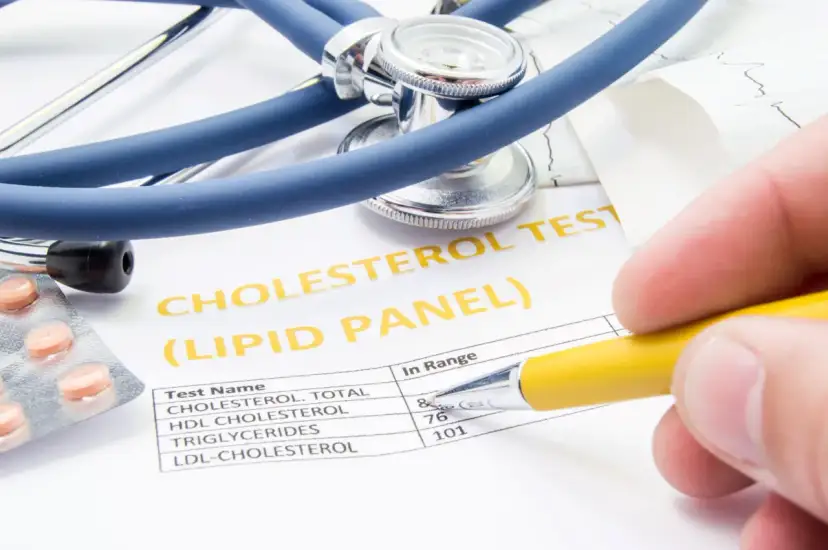 Wynik badania cholesterolu, stetoskop i tabletki. Dowiedz się, jak zbadać cholesterol.