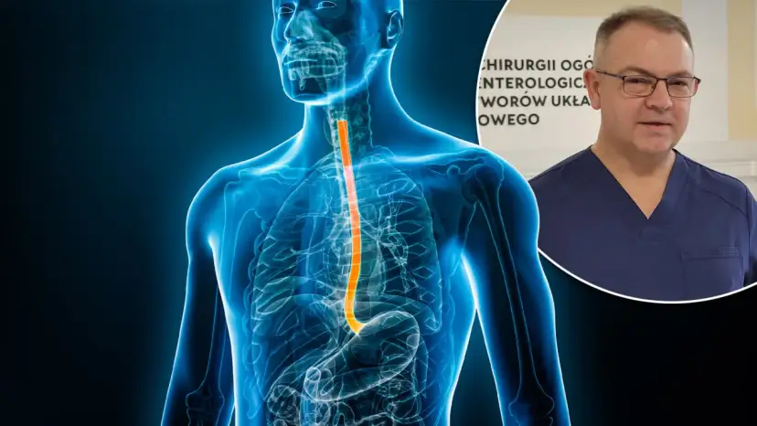 Rak przełyku: objawy wczesne i późne. Działaj, zanim będzie za późno