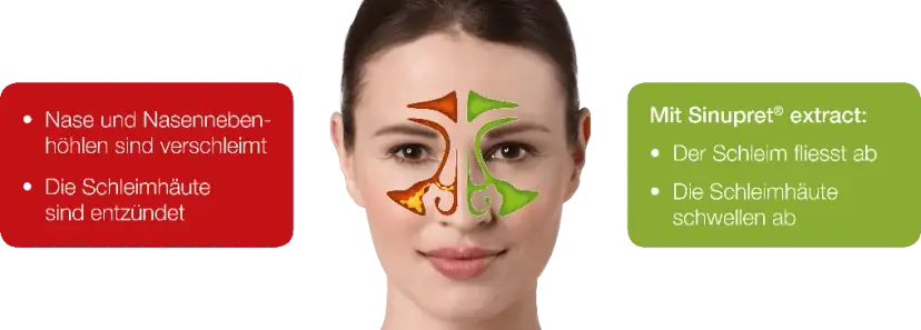 Die besten Medikamente bei Nasennebenhöhlenentzündung für schnelle Linderung