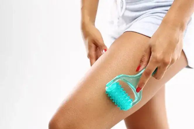 Cellulit na nogach: Skuteczne metody, dieta i ćwiczenia na gładką skórę