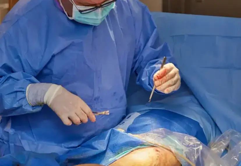 Żylaki: Flebolog, chirurg naczyniowy? Kto pomoże?