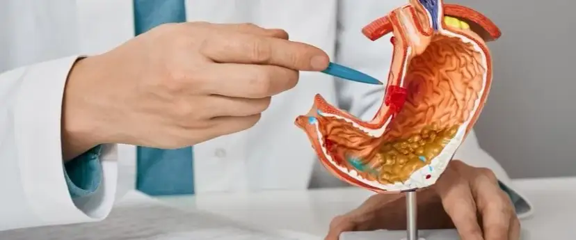 Jakie leki na nadkwasotę żołądka skutecznie łagodzą objawy?