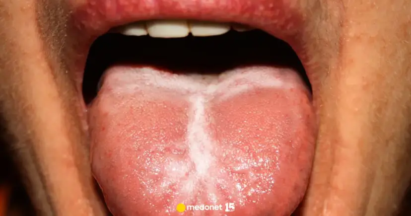 Alergia jamy ustnej: swędzenie po jedzeniu? Poznaj objawy i leczenie