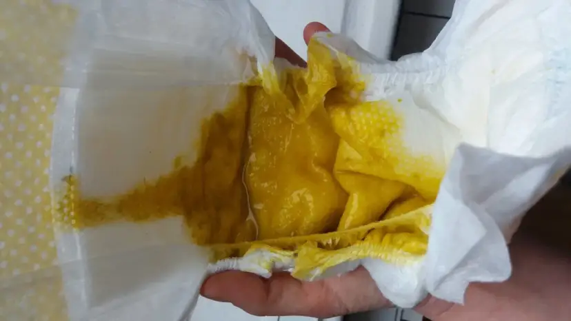 Niemowlę ma zaparcia? Sprawdzone sposoby i kiedy do lekarza