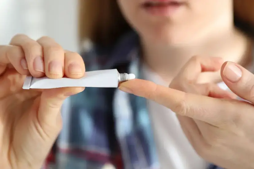 Dłoń trzymająca tubkę z maścią i aplikująca ją na palec.