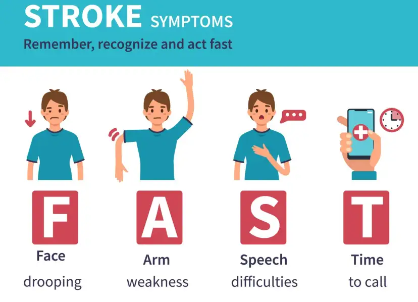 Ilustracja przedstawia objawy udaru mózgu: opadanie twarzy, osłabienie ręki, trudności z mową i wezwanie pomocy.