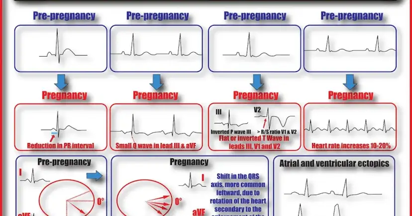 EKG w ciąży: kiedy jest konieczne i co musisz wiedzieć?