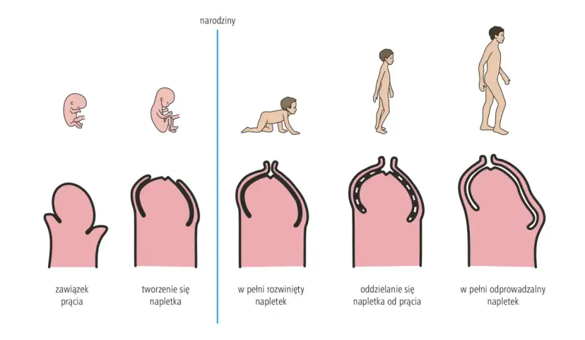 Stulejka: Urolog czy chirurg? Jak wybrać i skutecznie leczyć?