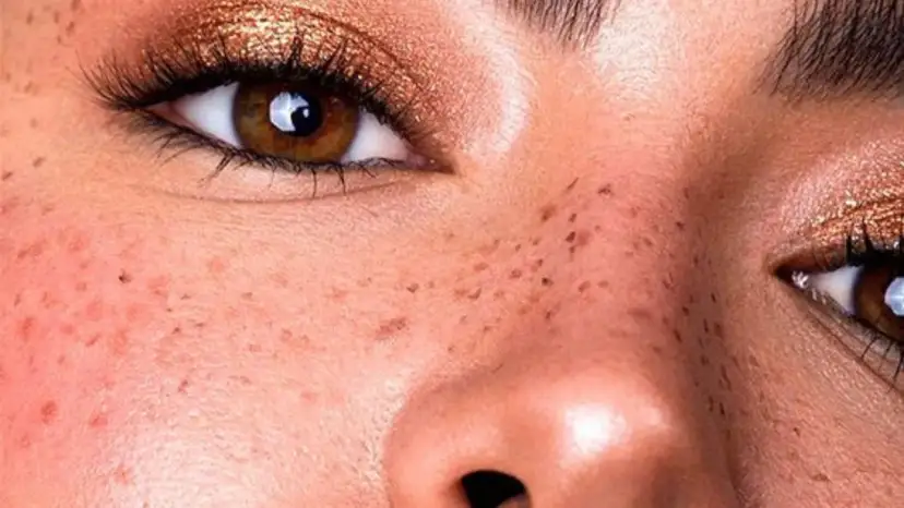 Henna do piegów: naturalne i trwałe. Jak to zrobić bezpiecznie?