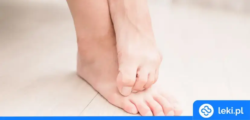 Skuteczne leki na grzybicę stóp - uniknij bólu i nawrotów
