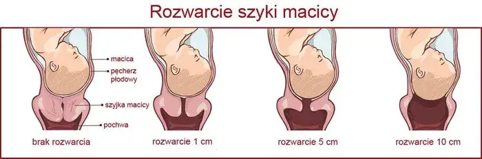 1 cm rozwarcia: Ile jeszcze do porodu? Sprawdź!