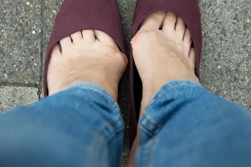 Rehabilitacja po operacji haluksa: plan ćwiczeń i powrót do sprawności