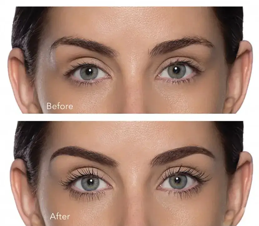 Botoks rzęs: co to jest? Poznaj efekty, ceny i czy warto!