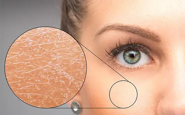 Trockene Gesichtshaut: Ursachen, Symptome und effektive Behandlungsmöglichkeiten