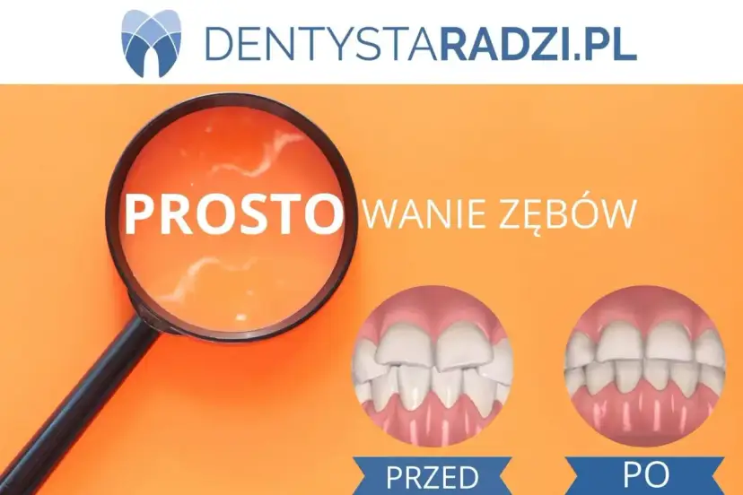Prostowanie zębów domowymi sposobami: mity, ryzyko i alternatywy
