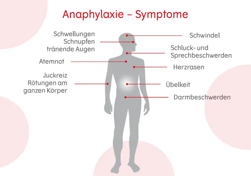 Allergie Symptome: So erkennen Sie gefährliche Reaktionen rechtzeitig