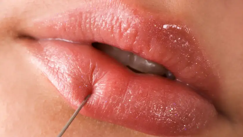 Powiększanie ust: Czy boli? Jak znieczulić i złagodzić ból?