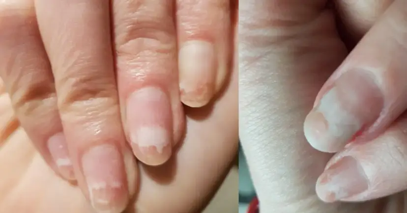 Jak wzmocnić paznokcie po hybrydzie i uniknąć ich zniszczenia