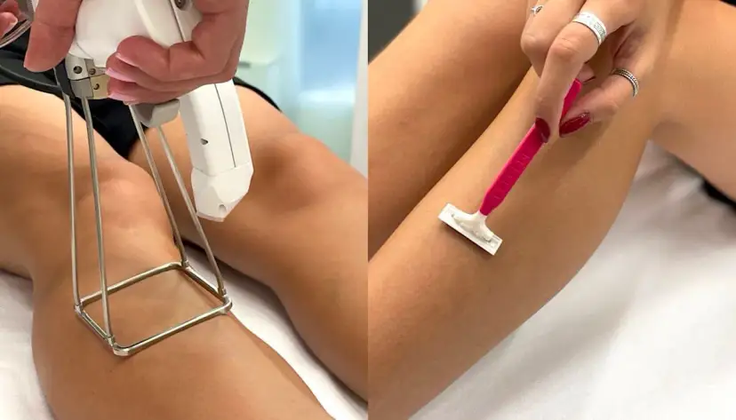 Epilacja – co to jest i jak skutecznie usunąć owłosienie?