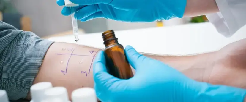 Na ile przed testami alergicznymi odstawić leki, aby uzyskać dokładne wyniki?