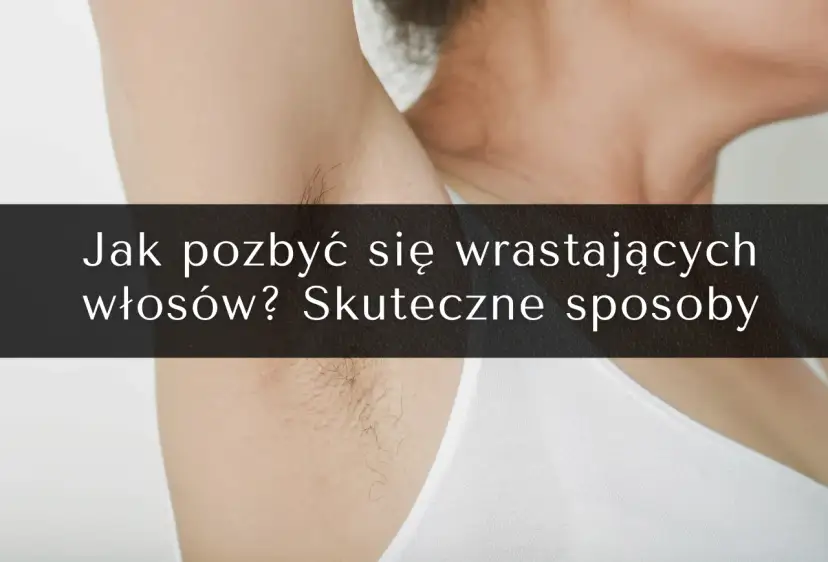 Skuteczne metody na wrastające włoski, które przynoszą ulgę