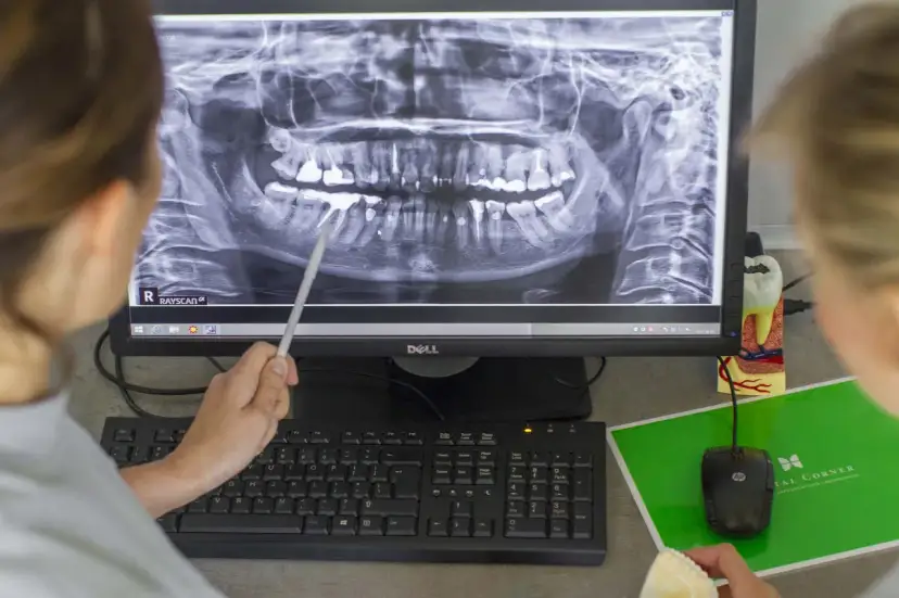 Górna dwójka: Jeden kanał to norma? Sprawdź, co mówi dentysta