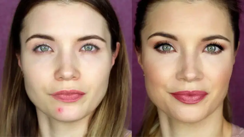 Jak ukryć pryszcza? Szybki makijaż i awaryjne triki