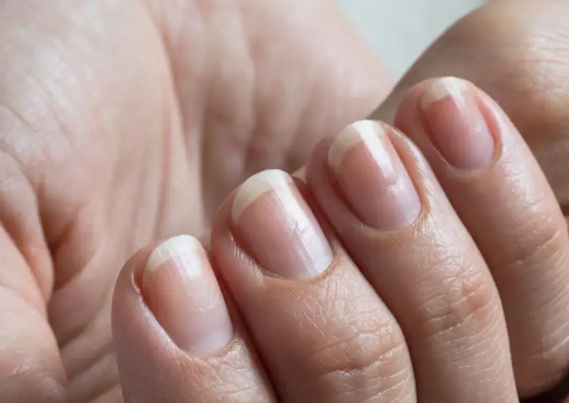 Jak odrasta paznokieć po zerwaniu? Pełny przewodnik regeneracji