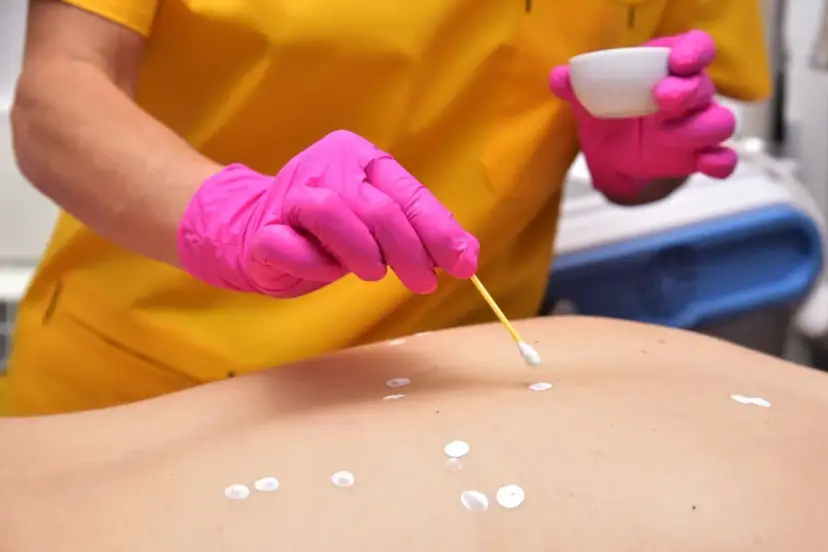 Czy maść cynkowa naprawdę pomaga na pryszcze? Sprawdź efekty!