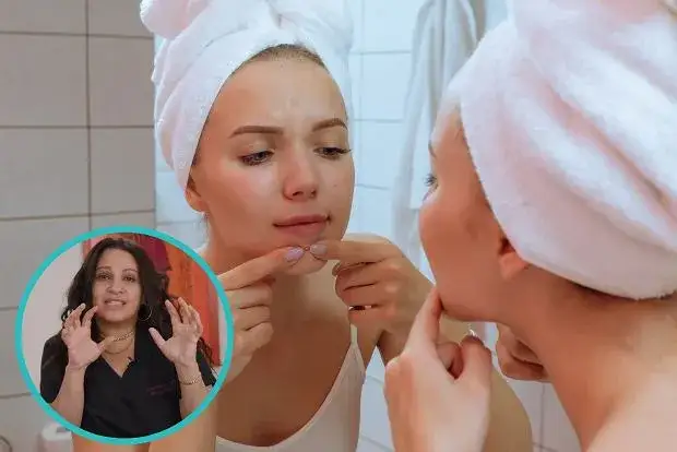 Jak bezpiecznie wycisnąć pryszcz? Zasady, których musisz przestrzegać