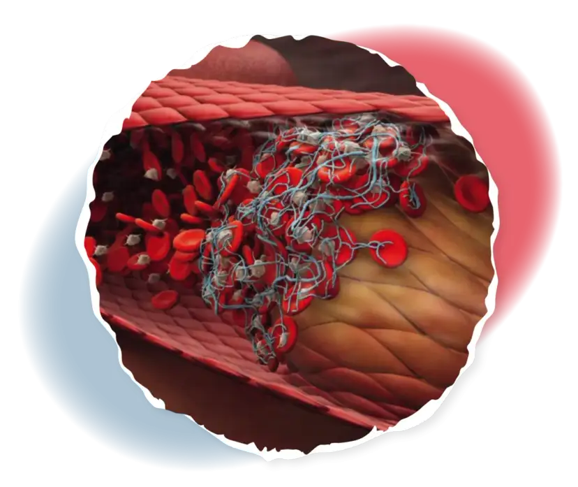 Polycythaemia vera symptome: Erkennen Sie die versteckten Warnsignale