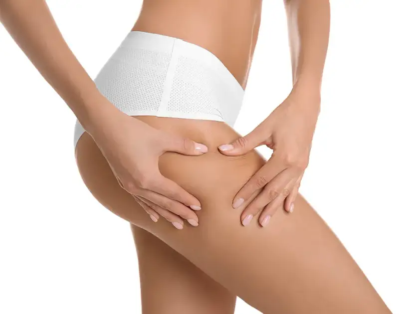 Jak pozbyłam się cellulitu? Mój sprawdzony plan 4w1