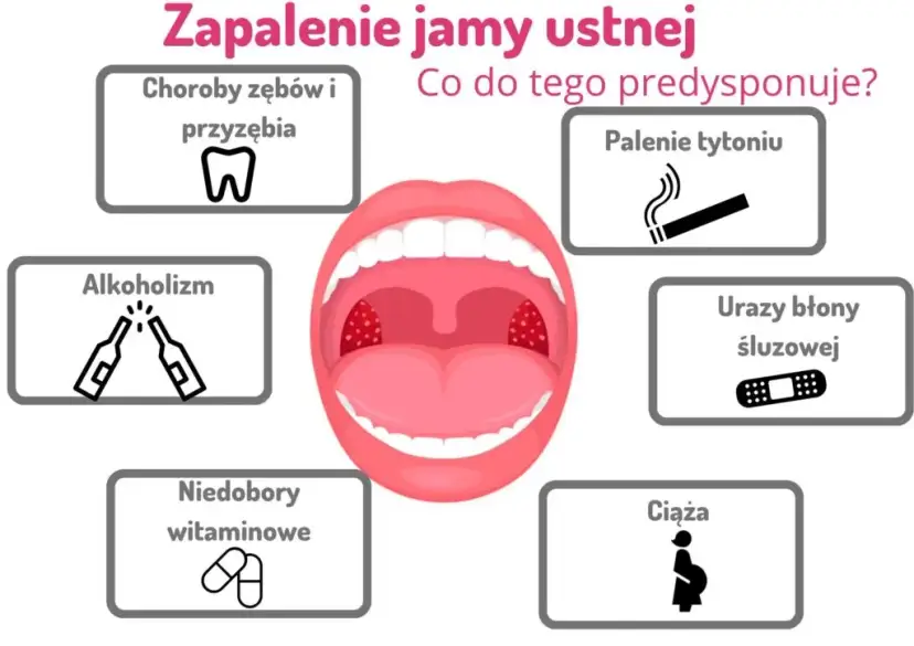 Skuteczne płukanki na stan zapalny jamy ustnej, które przynoszą ulgę