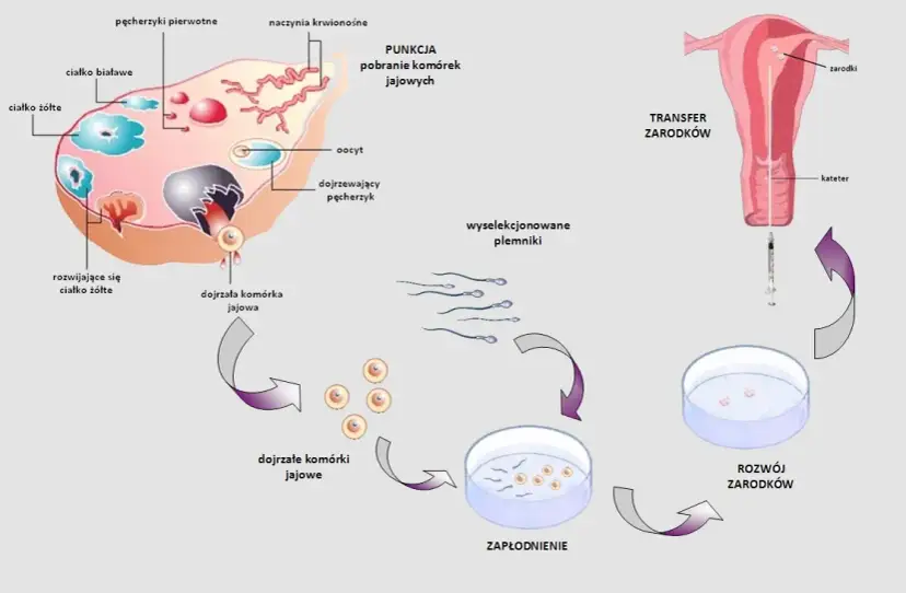Ile można zarobić na oddaniu komórki jajowej? Poznaj prawdę o wynagrodzeniu