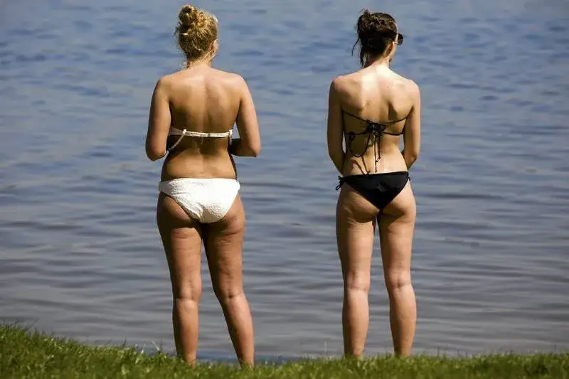 Jak ukryć cellulit na plaży? Skuteczne sposoby na pewność siebie