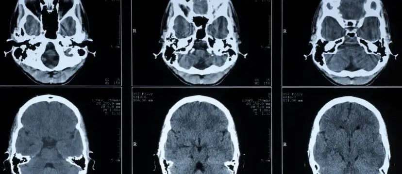 Die Bedeutung der medizinischen Diagnostik für präzise Krankheitsdiagnosen