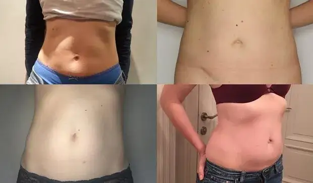 Twój brzuch w drugiej ciąży: Szybciej i większy? To normalne!