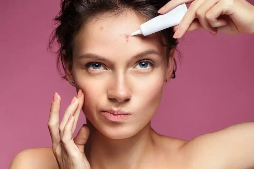 Skuteczne metody na pryszcze - jak szybko pozbyć się problemu