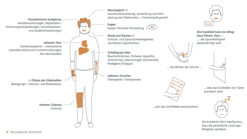 Morbus Wilson Diagnose: Schritte, Tests & Symptome erklärt