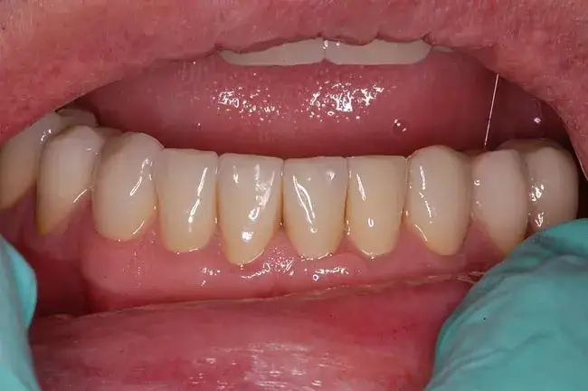 Zdrowe dziąsła: jak je rozpoznać i kiedy szukać pomocy?