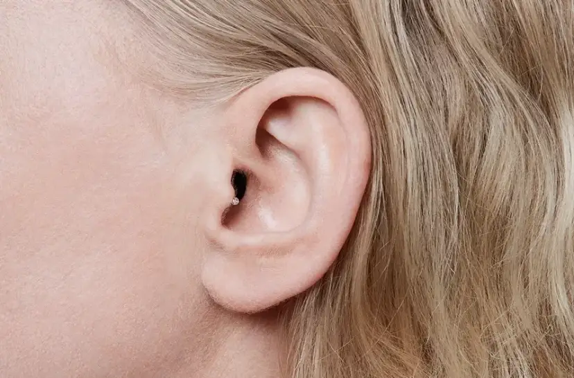 Aparaty słuchowe z akumulatorami: nowoczesne rozwiązanie dla osób z problemami ze słuchem