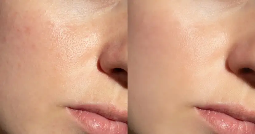 Aplikacja kremu BB: Sekret nieskazitelnej cery bez efektu maski