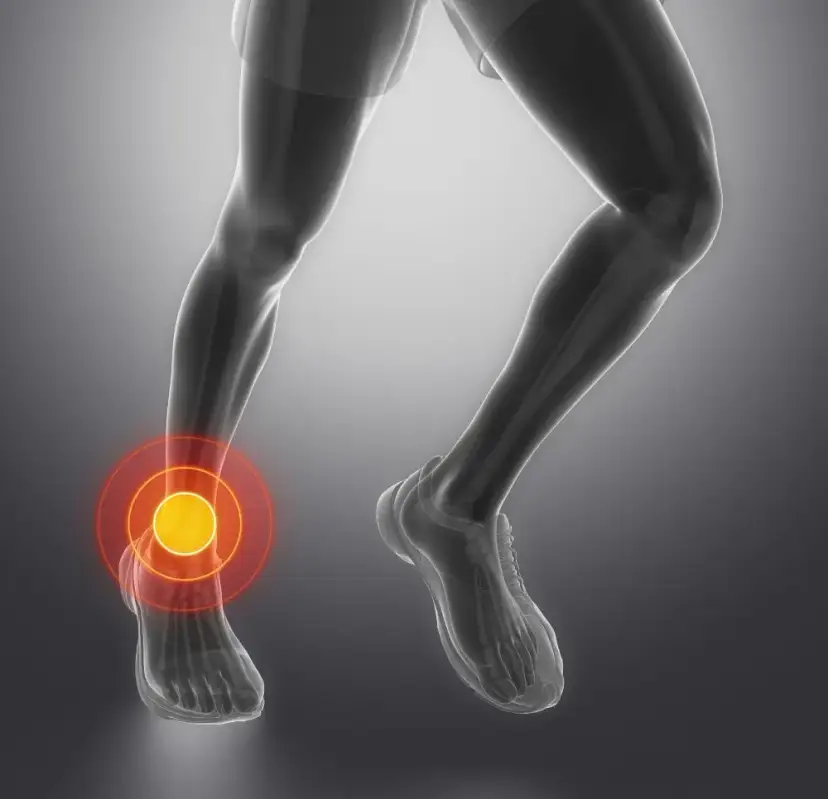 Rehabilitacja stawu skokowego: ile trwa powrót do sprawności?
