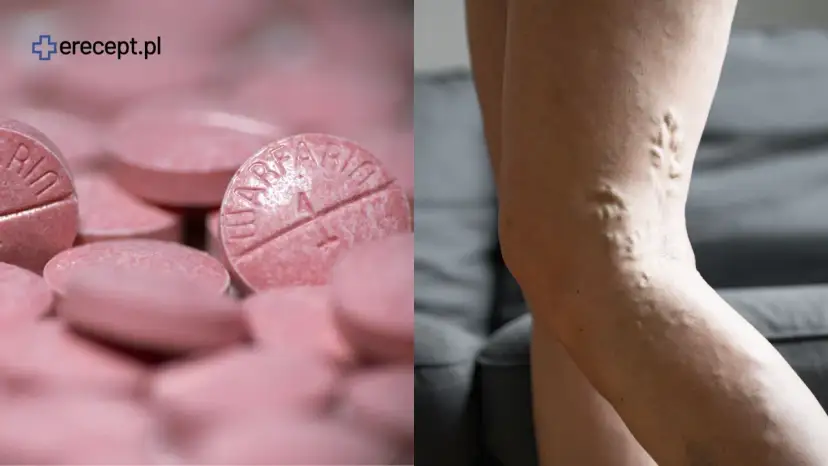 Leki rozrzedzające krew a witamina K: jedz bezpiecznie i stabilnie!