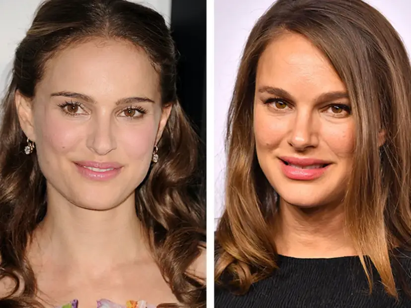 Natürliche Lippenschattierung: Vorher-Nachher für Traumlippen