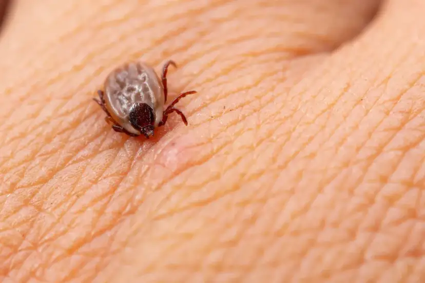 Kleszcz się urwał? Sprawdź, jak usunąć resztki i uniknąć boreliozy