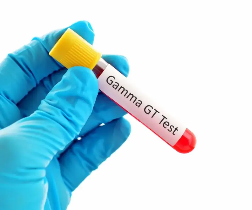 GGTP co to za badanie i jak może uratować Twoje zdrowie?