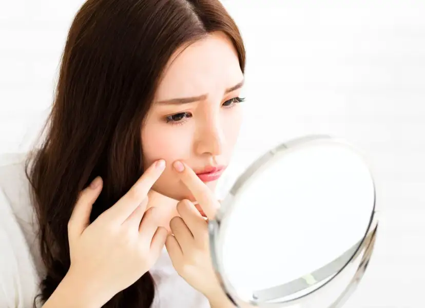 Młoda kobieta zmartwiona ogląda pryszcze na twarzy w lusterku.